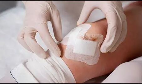 Feridas de Cirurgias